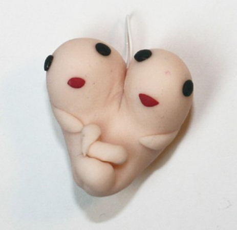 conjoined twin decorations